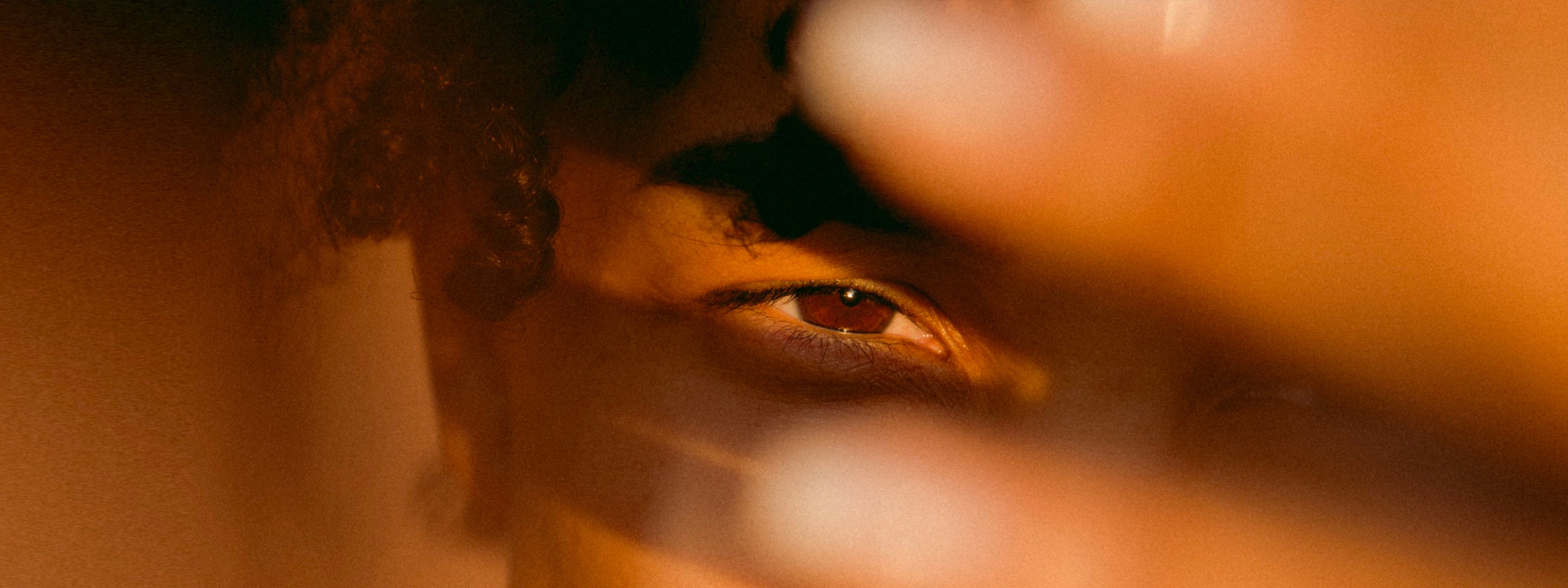 Dermatologist Weighs In: Why Psoriasis Looks Different on Dark Skin