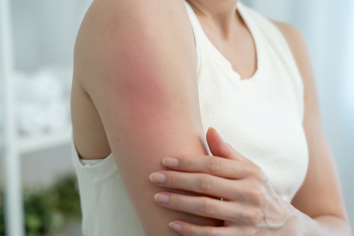 7 Signs You Have Sensitive Skin