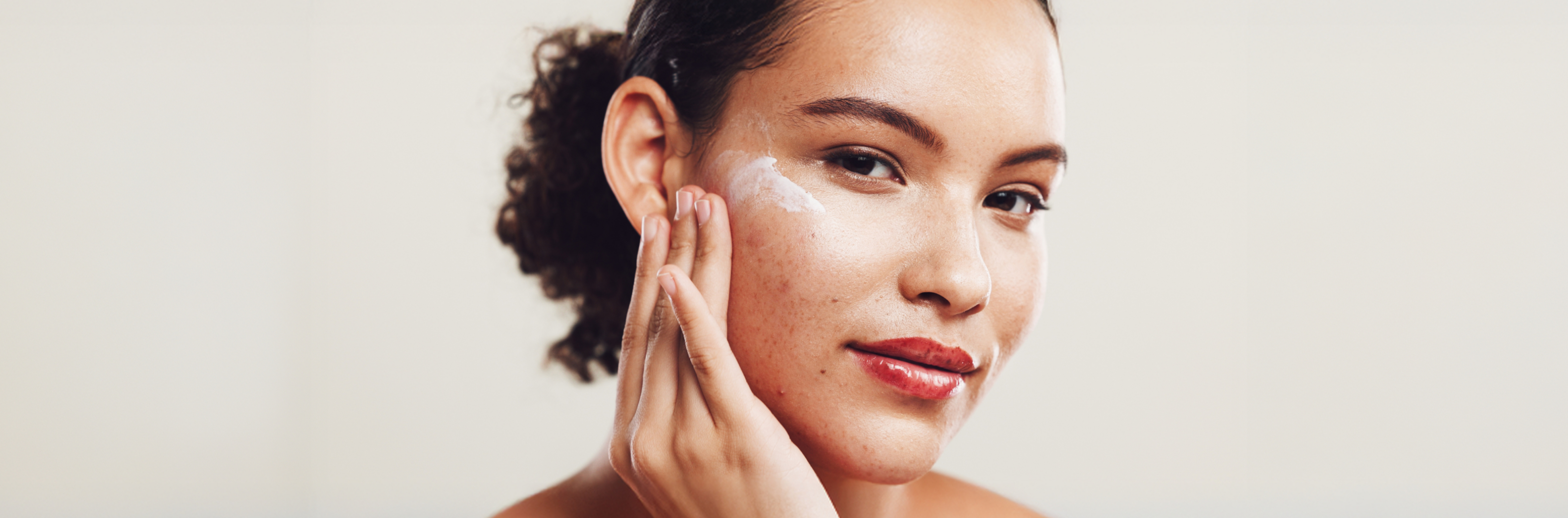 Acne Awareness Month - The Essential Role of SPF in Preventing Breakouts and Scars