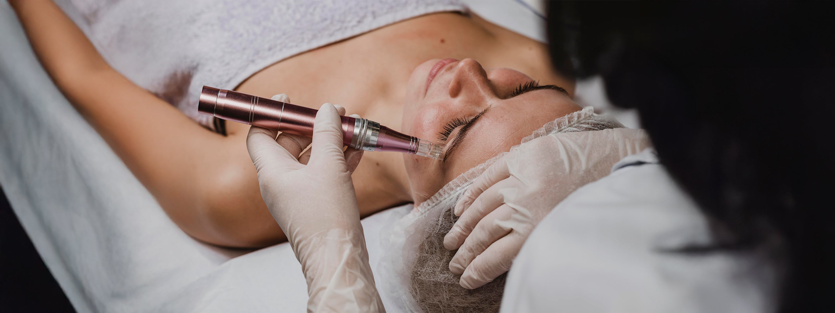 What To Do Before And After A Microneedling Treatment To Protect Your Skin From Sun Damage
