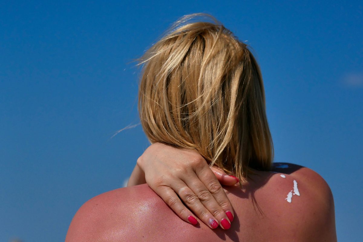 Woman rubs sunscreen on his shoulder. Against the background of the sea