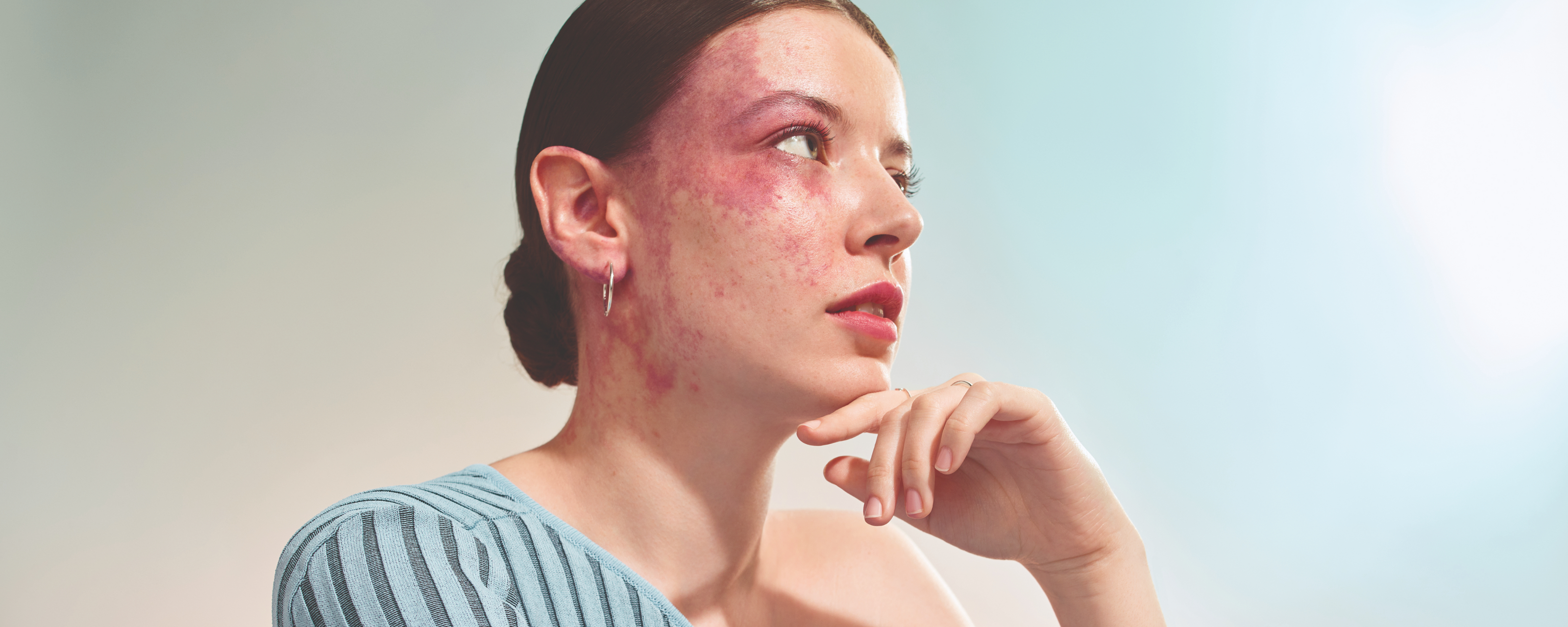 Graphic layout featuring SunsolveMD products and textures